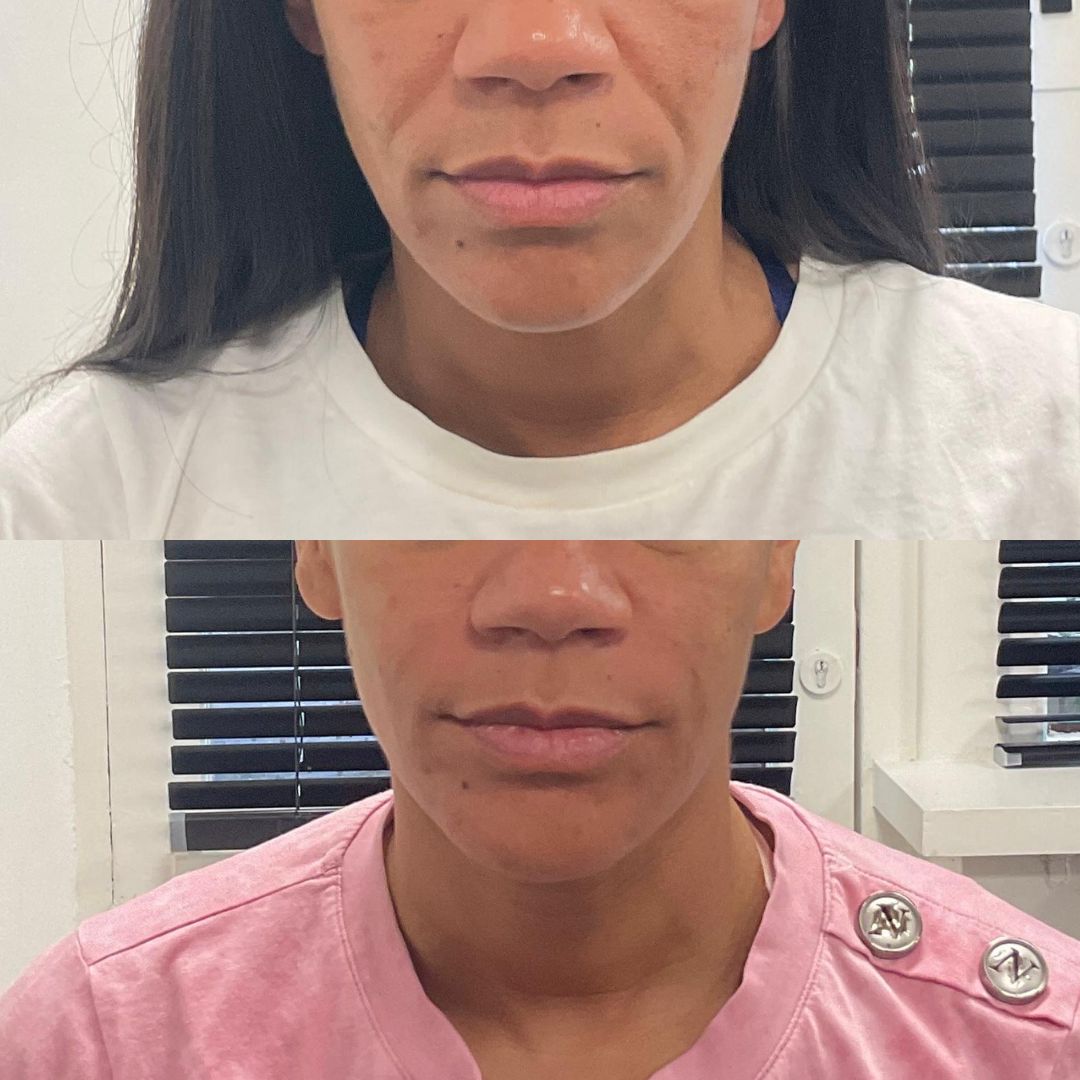 grid-img-{{ loop.index }} 