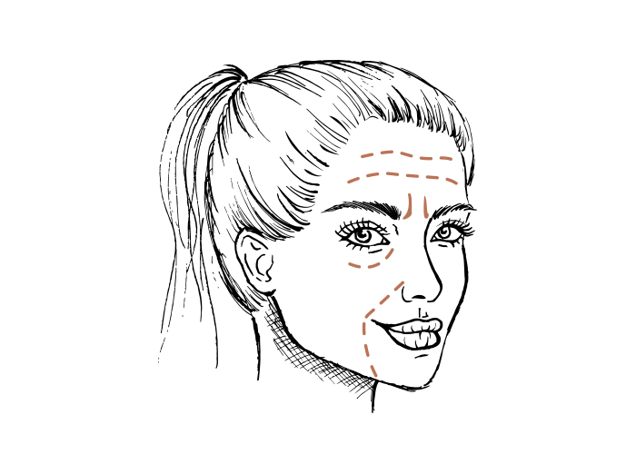 Dit is hét alternatief voor rimpels laseren