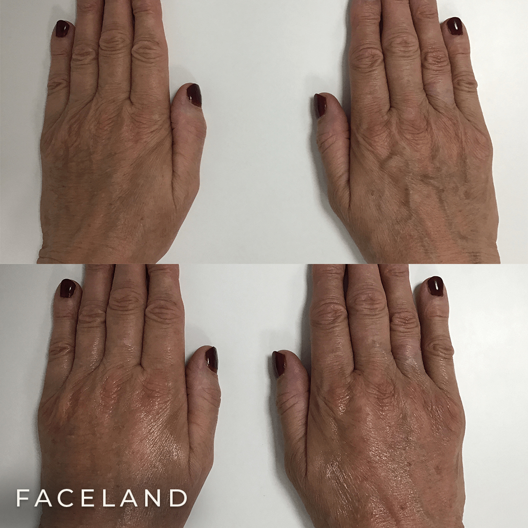 grid-img-{{ loop.index }} 