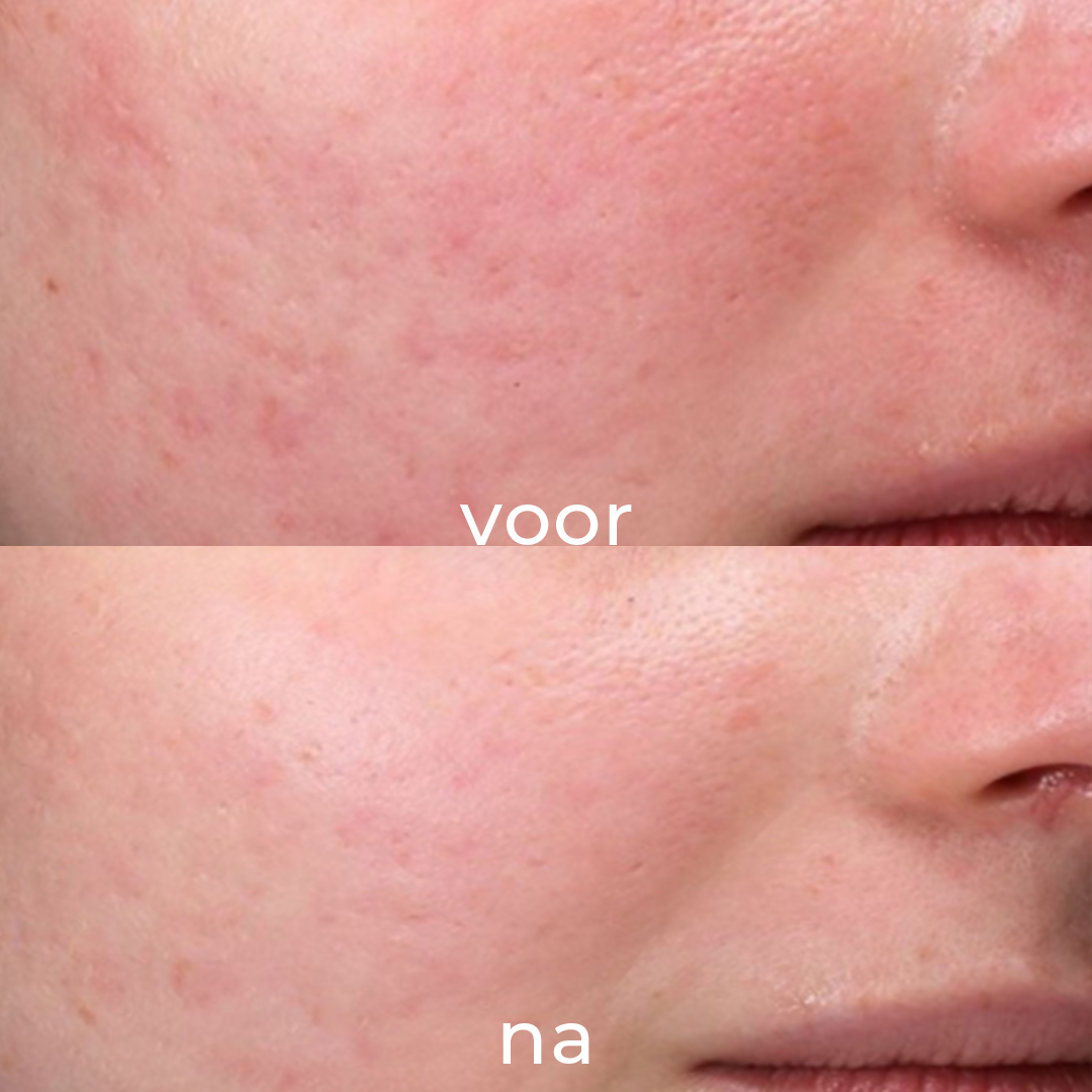 grid-img-{{ loop.index }} 