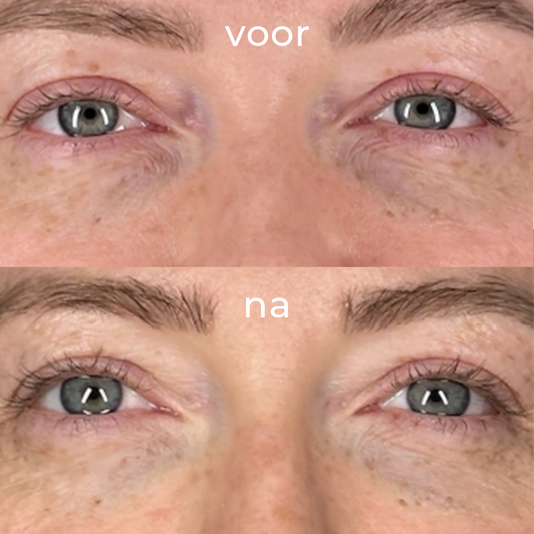 grid-img-{{ loop.index }} 