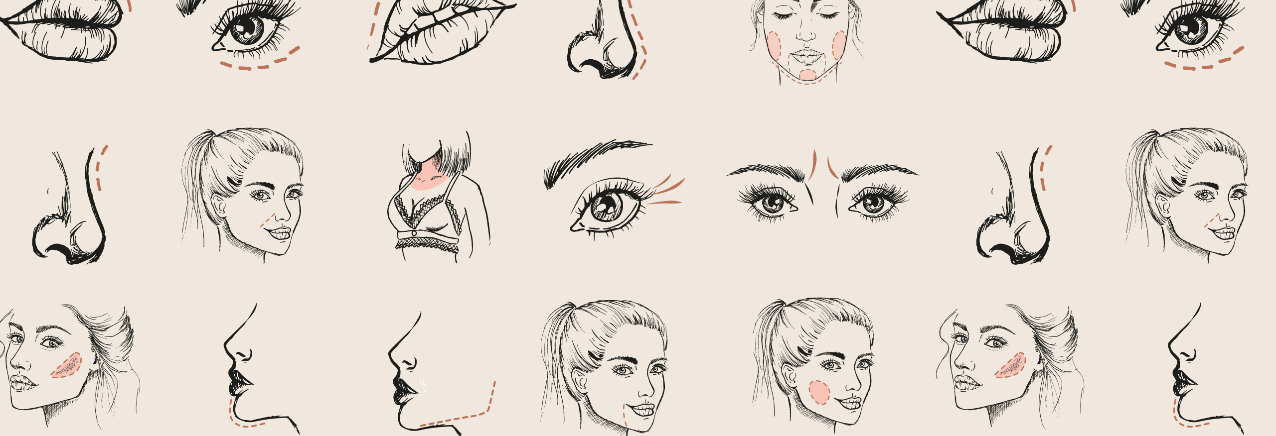 Traangoot filler voor en na