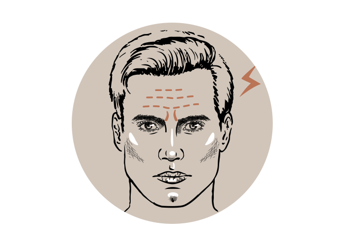 Muskelrelaxans gegen Migräne