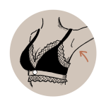 Hyperhidrose behandeling