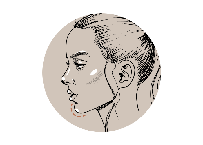 Kuiltje in kin? Zo krijg je ‘m weg