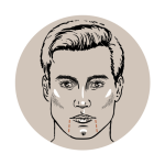 Marionettenfalten unterspritzen