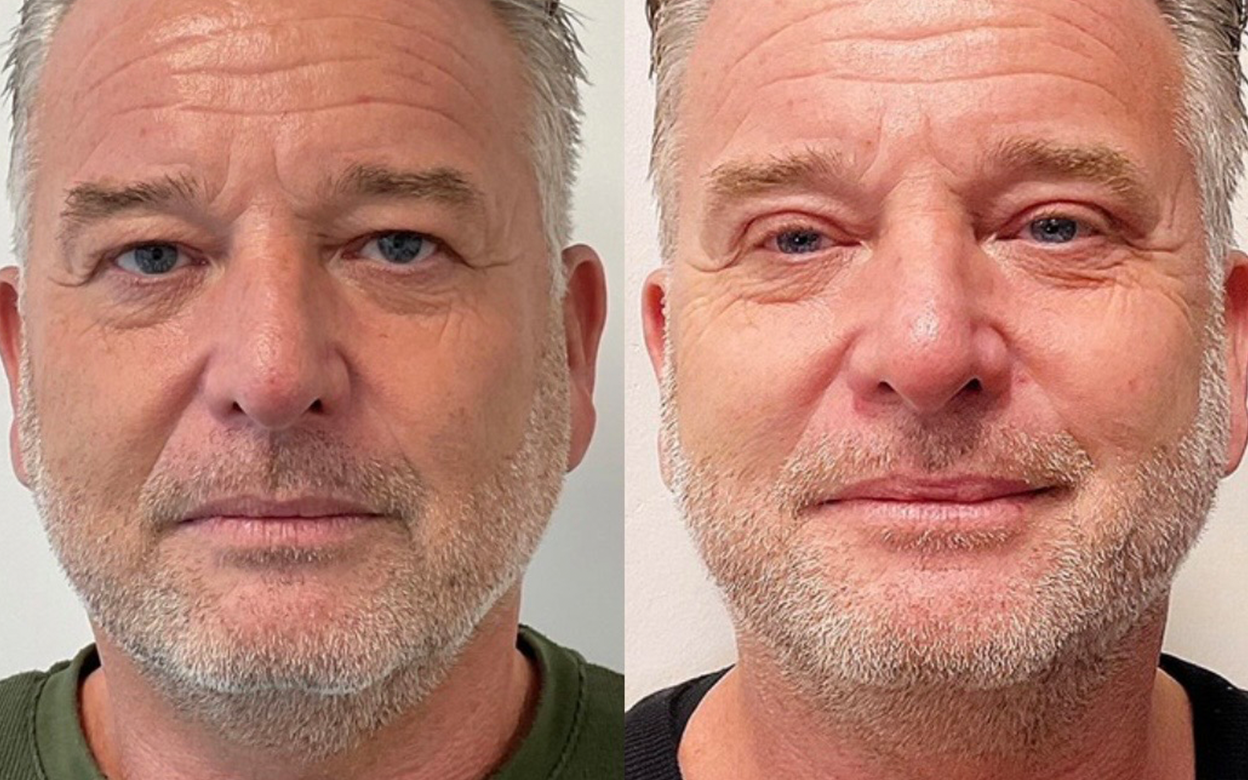 grid-img-{{ loop.index }} 