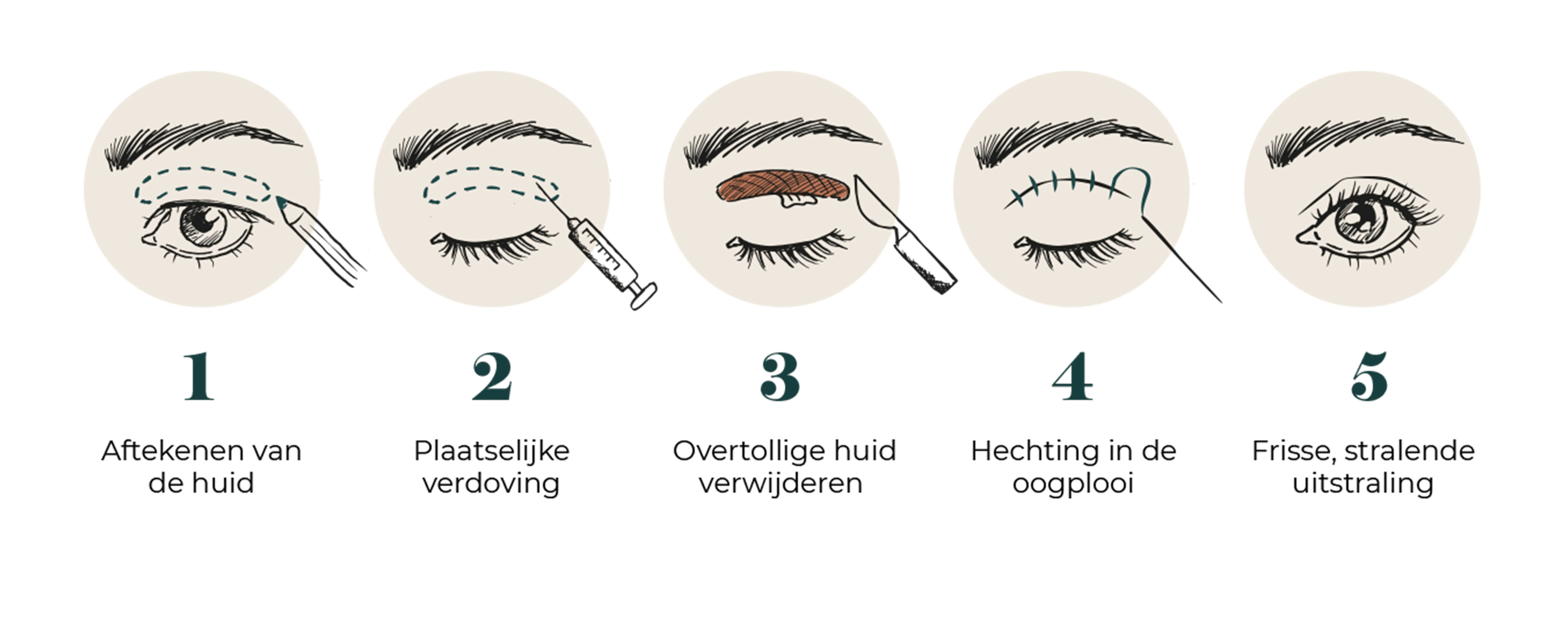 Last van ogen? Dit is de oplossing