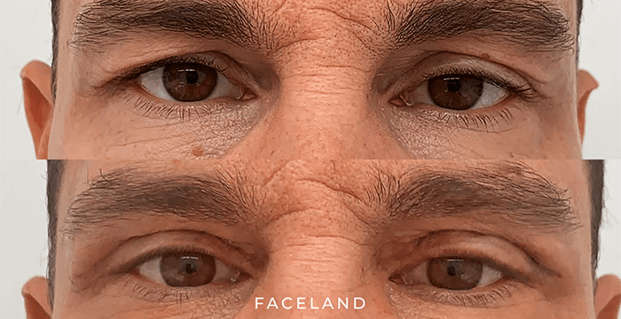 grid-img-{{ loop.index }} 