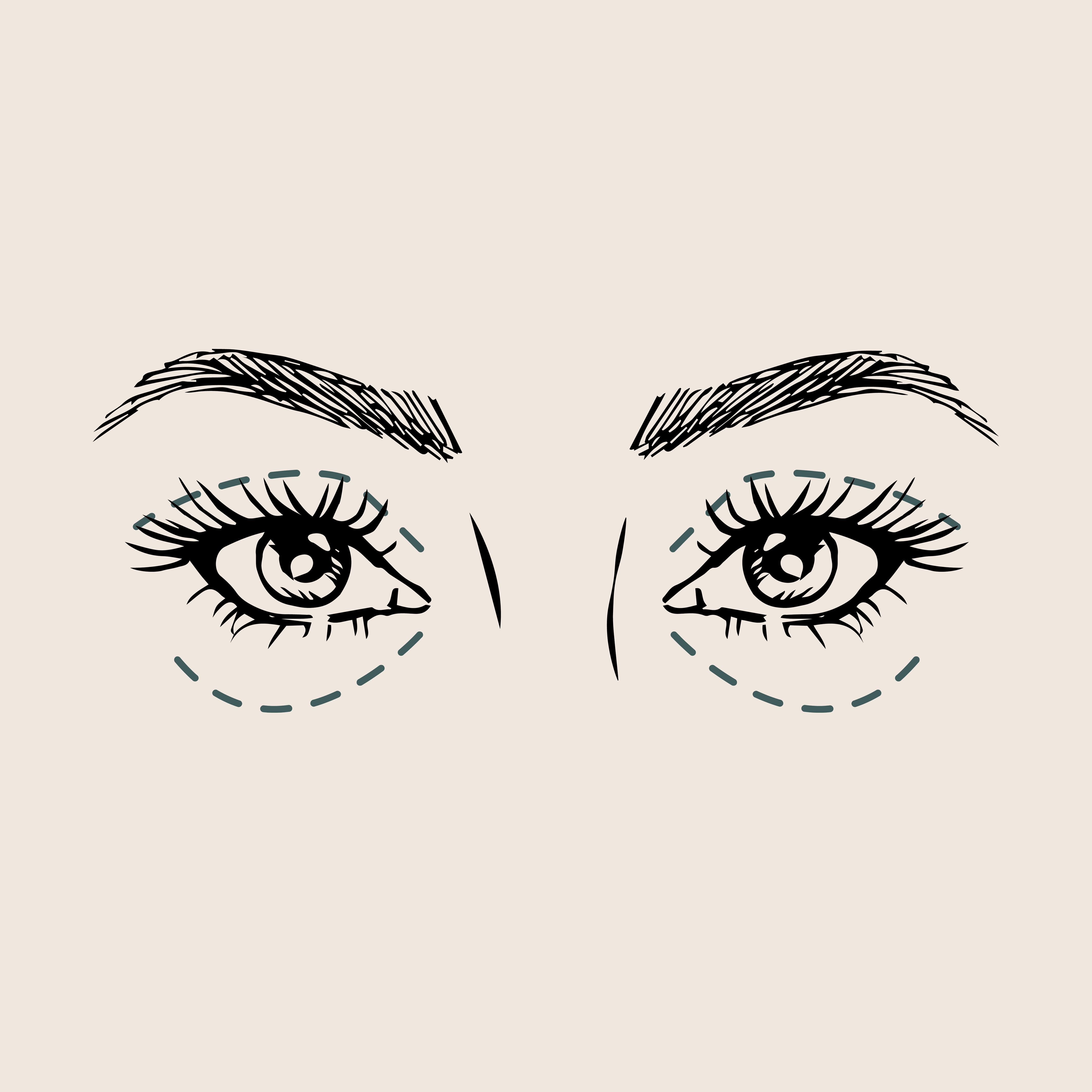 Boven en onderooglidcorrectie: de verschillen