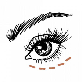 Wat te doen tegen wallen onder de ogen?
