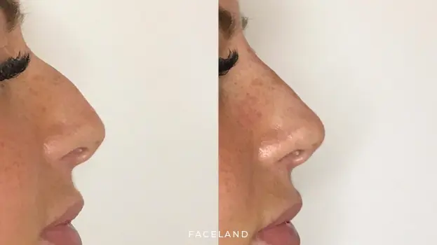 Faceland