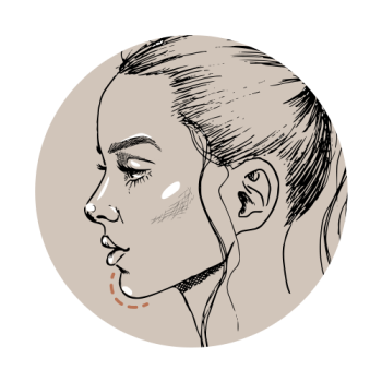 Kuiltje in kin? Zo krijg je ‘m weg