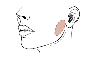 Face Slimming