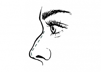 Neuscorrectie