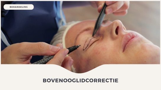 Bovenooglidcorrectie