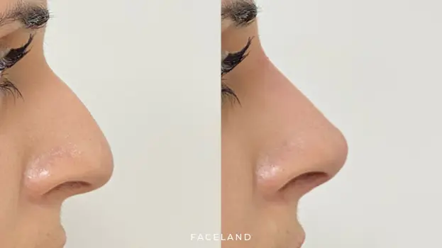 Faceland