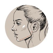 Kauwgom kauwen voor strakke kaaklijn? Nee, ga voor fillers!