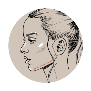 Je gezicht contouren? Dat doe je met injectables!