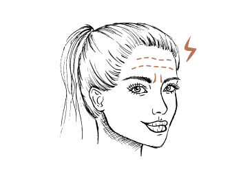 Migraine behandeling