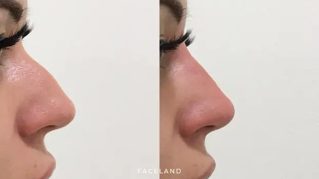 Faceland
