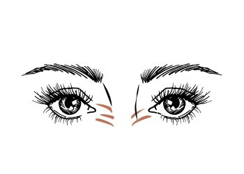 Bunny lines