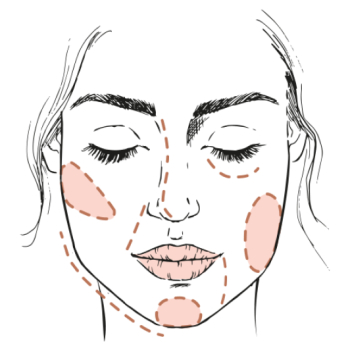 Waarom fillers beter zijn dan lipofilling in gezicht