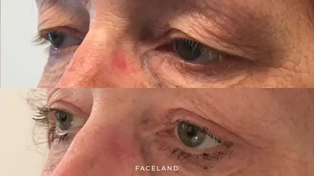 Faceland