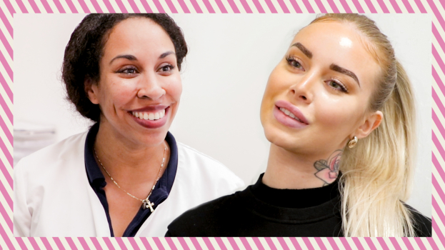 Lippen opvullen resultaat