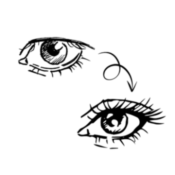 Dit zijn de ooglidcorrectie voor en nadelen