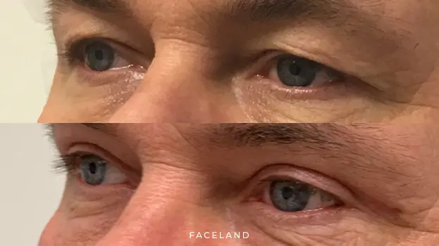 Faceland