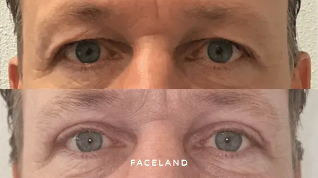 Faceland