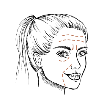 Dit is hét alternatief voor rimpels laseren