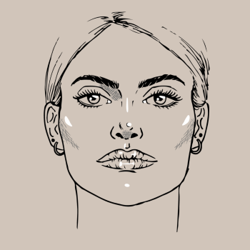 Profhilo Structura: effetto lifting e volume naturale