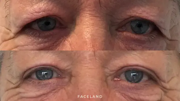 Faceland