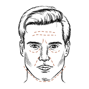 Brotox oder Menjections? Diese 5 Injektionsbehandlungen sind bei Männern beliebt