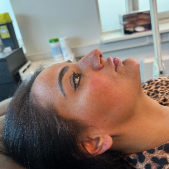 ‘Ik heb eigenlijk totaal geen bovenlip’ – Nihals lipfillerverhaal bij Faceland