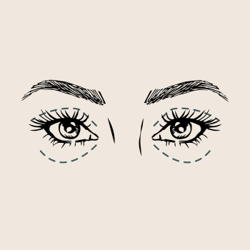 Boven en onderooglidcorrectie: de verschillen