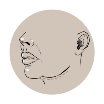 Onderkin trainen? Nee, deze methode helpt écht