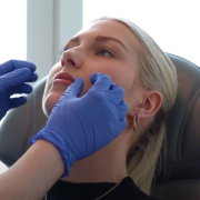 Een natuurlijk vollere glimlach: Milou’s lip filler ervaring