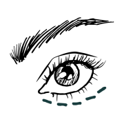 Weg met dikke wallen: oorzaak en oplossingen