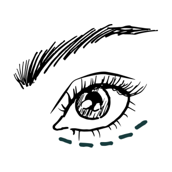 Weg met dikke wallen: oorzaak en oplossingen