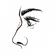 Wil je een neuscorrectie zonder operatie? Dat kan met de 2-point Rhino techniek!