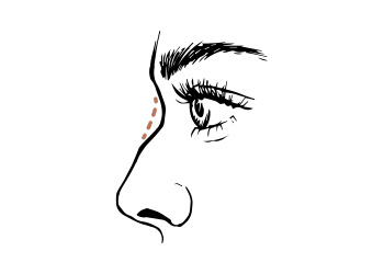 Neusbrug