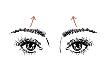 Wenkbrauwlift