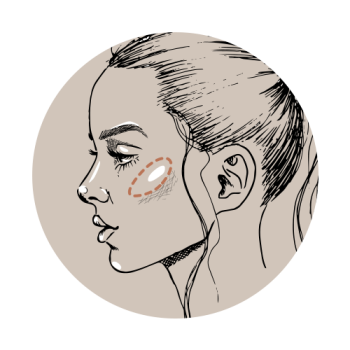 Zo voorkom je pijn in jukbeenderen na fillers