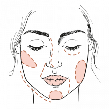 4 feiten over fillers