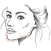 Kaaklijn filler: zo krijgt u een strakke kaaklijn