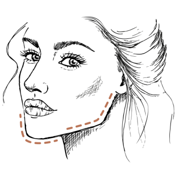 Kaaklijn filler: zo krijgt u een strakke kaaklijn