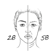 Wat is de ideale ooglidcorrectie leeftijd?